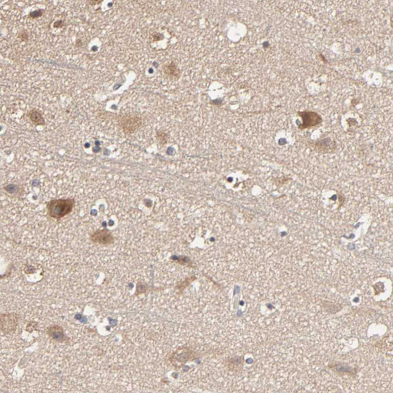 Atlas Antibodies Anti-ARHGEF7 Antibody