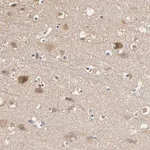 Atlas Antibodies Anti-ARHGEF7 Antibody