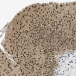Atlas Antibodies Anti-ARID1B Antibody