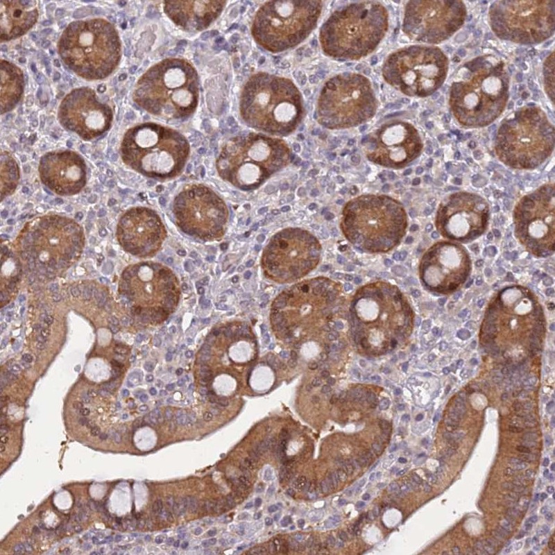 Atlas Antibodies Anti-ARHGEF5 Antibody