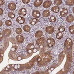 Atlas Antibodies Anti-ARHGEF5 Antibody