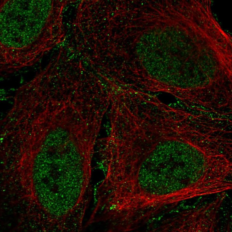 Atlas Antibodies Anti-ARID1B Antibody
