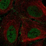 Atlas Antibodies Anti-ARID1B Antibody