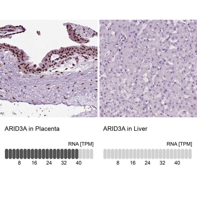 Atlas Antibodies Anti-ARID3A Antibody