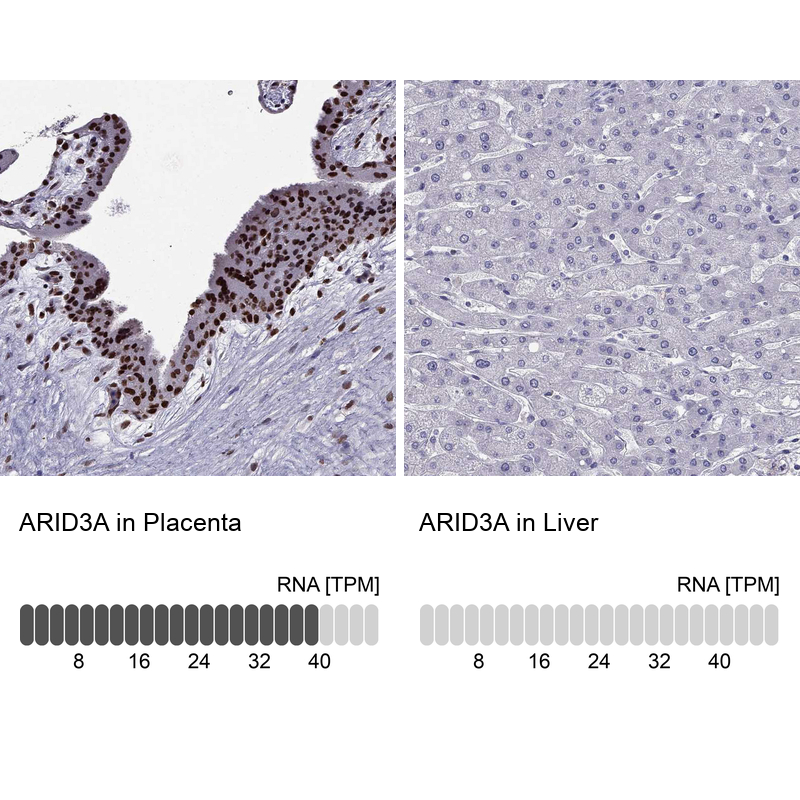 Atlas Antibodies Anti-ARID3A Antibody