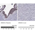 Atlas Antibodies Anti-ARID3A Antibody
