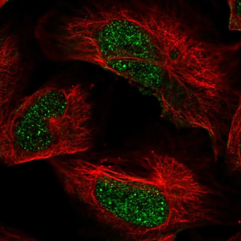 Atlas Antibodies Anti-ARID2 Antibody