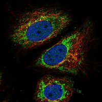 Atlas Antibodies Anti-ARID4B Antibody