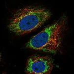 Atlas Antibodies Anti-ARID4B Antibody