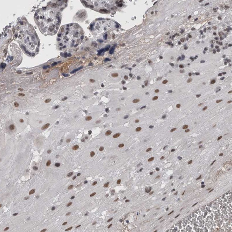 Atlas Antibodies Anti-ARID4B Antibody