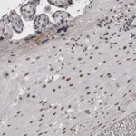 Atlas Antibodies Anti-ARID4B Antibody