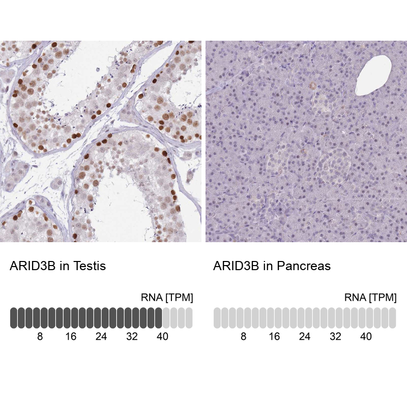 Atlas Antibodies Anti-ARID3B Antibody