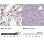 Atlas Antibodies Anti-ARID3B Antibody