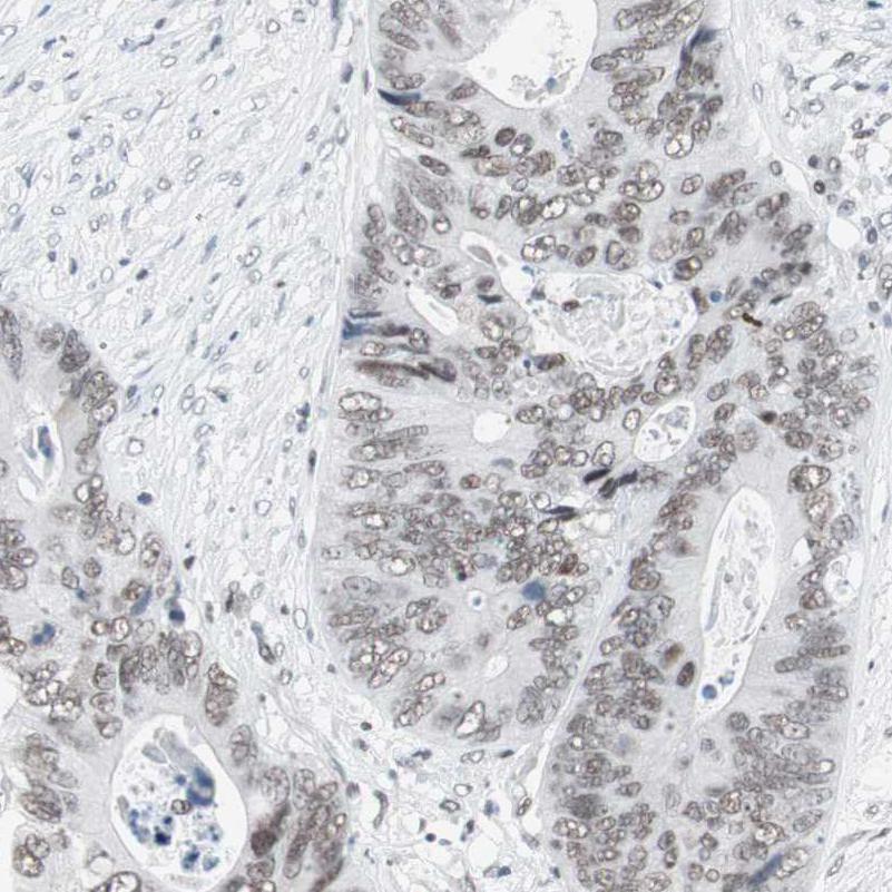 Atlas Antibodies Anti-ARID1A Antibody