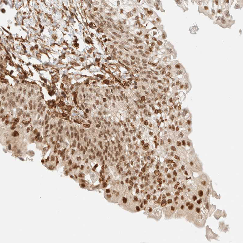 Atlas Antibodies Anti-ARID5A Antibody