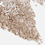 Atlas Antibodies Anti-ARID5A Antibody