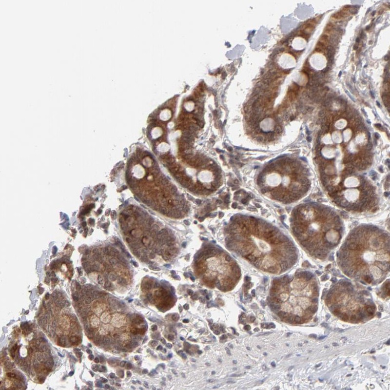 Atlas Antibodies Anti-ARIH1 Antibody