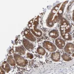 Atlas Antibodies Anti-ARIH1 Antibody
