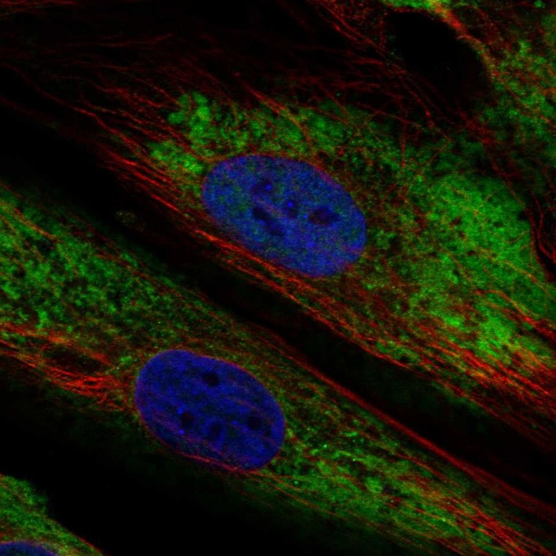 Atlas Antibodies Anti-ARID5B Antibody