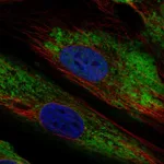 Atlas Antibodies Anti-ARID5B Antibody