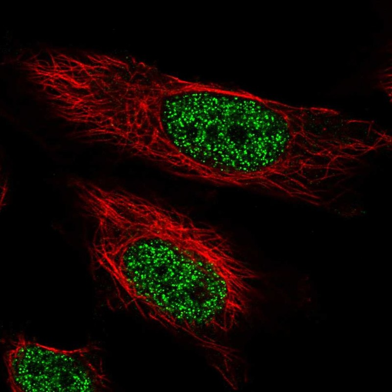 Atlas Antibodies Anti-ARIH2 Antibody