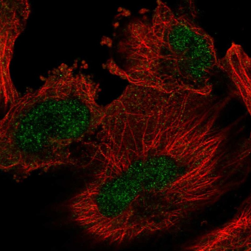 Atlas Antibodies Anti-ARIH2 Antibody