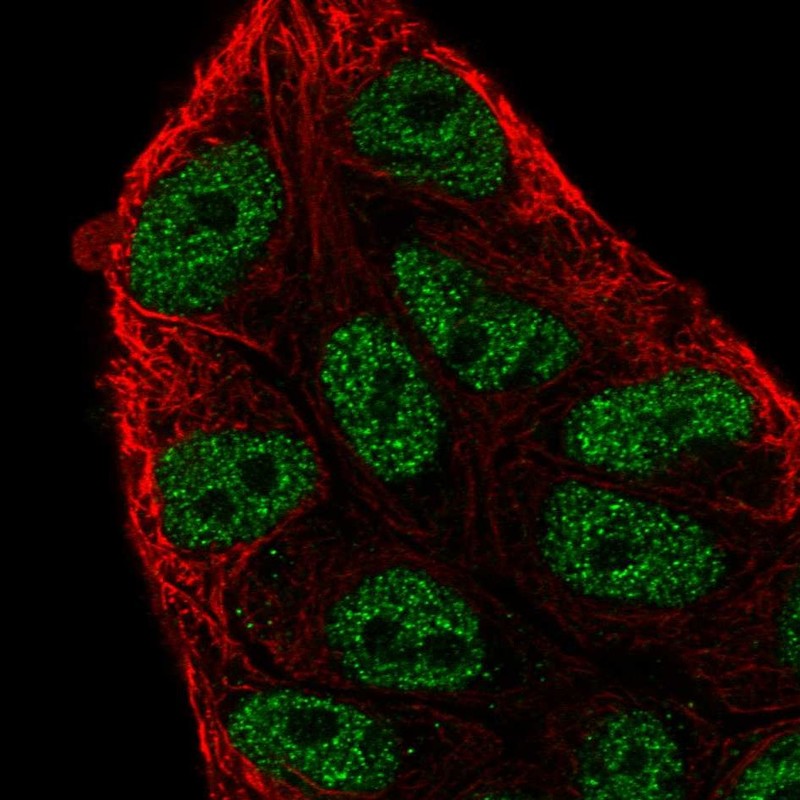 Atlas Antibodies Anti-ARIH2 Antibody