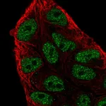 Atlas Antibodies Anti-ARIH2 Antibody