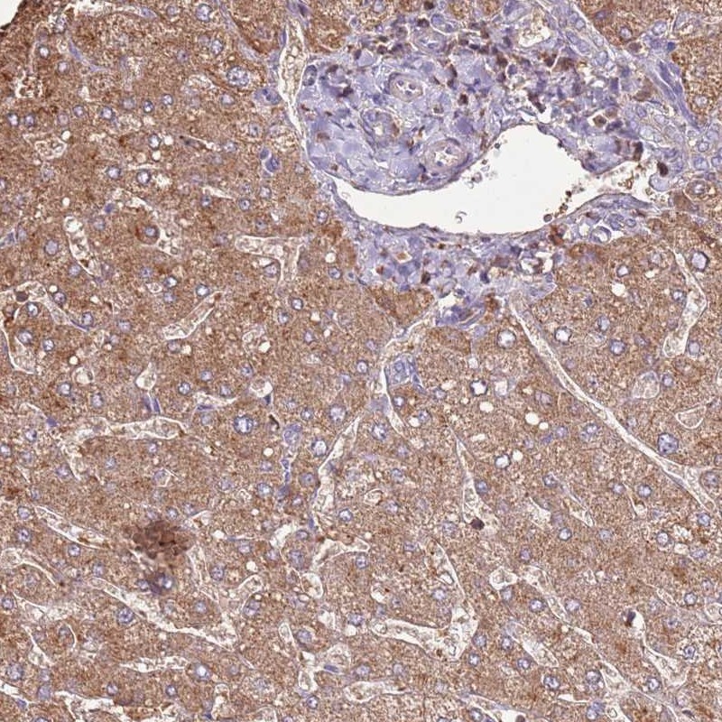 Atlas Antibodies Anti-ARL10 Antibody