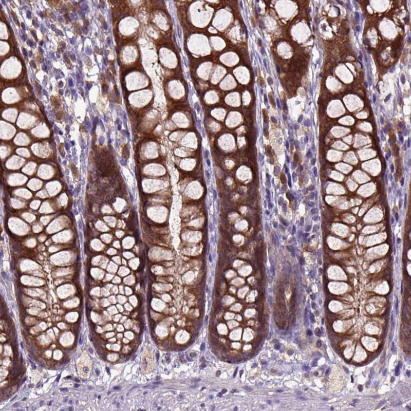 Atlas Antibodies Anti-ARL1 Antibody