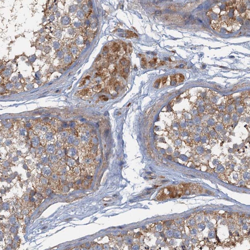 Atlas Antibodies Anti-ARL11 Antibody