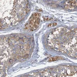 Atlas Antibodies Anti-ARL11 Antibody
