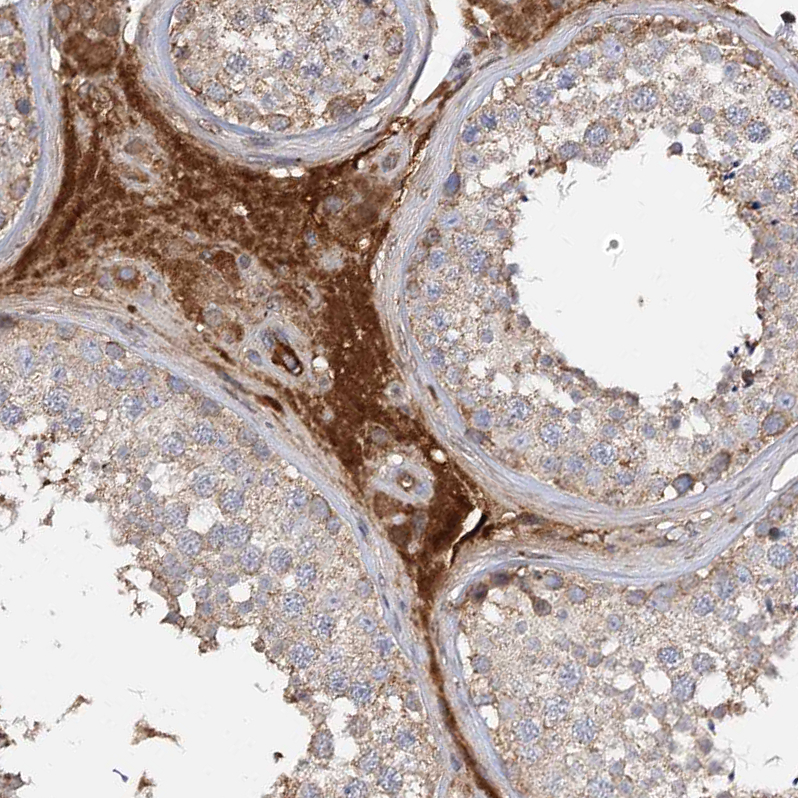 Atlas Antibodies Anti-ARL13A Antibody