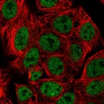 Atlas Antibodies Anti-ARRB1 Antibody