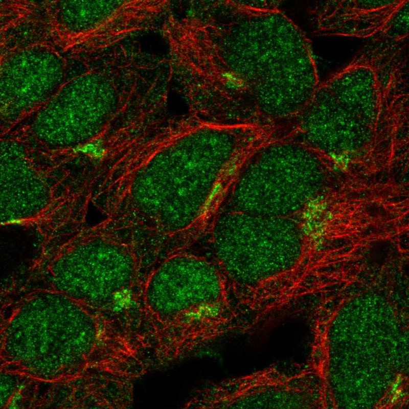 Atlas Antibodies Anti-ASB13 Antibody