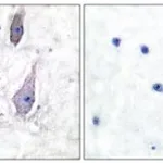 Merck ANTI-PMP22 ANTIBODY PRODUCED IN RABBIT