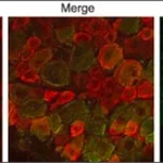 Merck Anti-Sodium Channel NaV1.8 antibody produced in rabbit