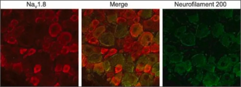 Merck Anti-Sodium Channel NaV1.8 antibody produced in rabbit