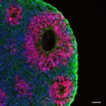 Thermo Fisher Scientific Donkey anti-Mouse IgG (H+L) ReadyProbes Secondary Antibody, Alexa Fluor 488