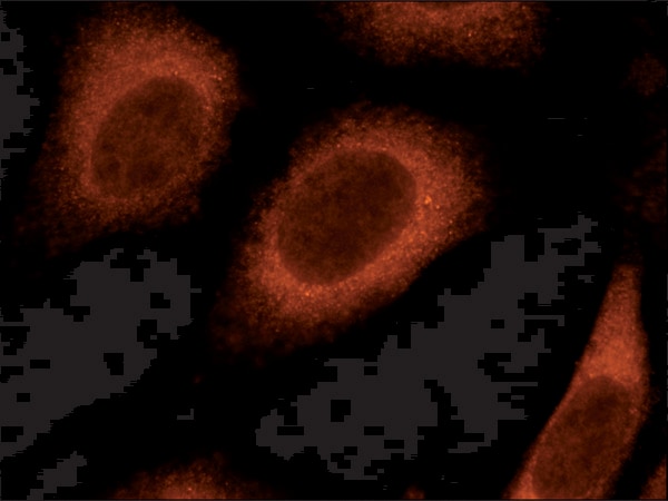 Merck Anti-Rab8 antibody produced in rabbit
