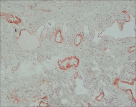 Merck Anti-Tenascin antibody, Mouse monoclonal