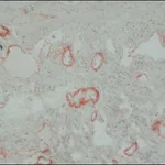 Merck Anti-Tenascin antibody, Mouse monoclonal