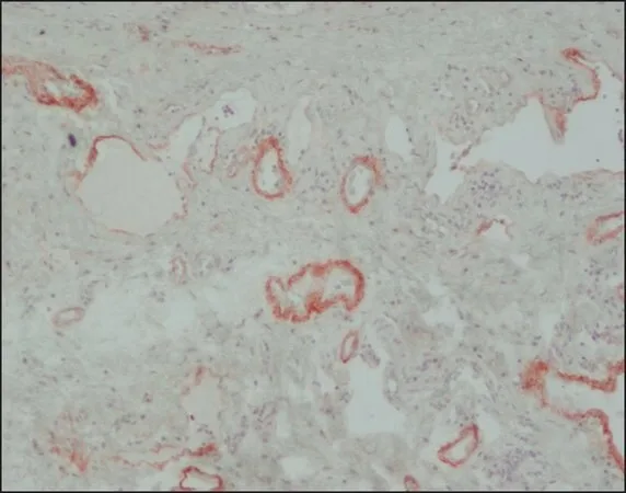 Merck Anti-Tenascin antibody, Mouse monoclonal