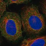 Merck Anti-LECT2 antibody produced in rabbit