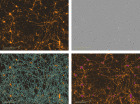 Incucyte® Neurotrack Analysis Software Module