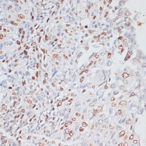 Merck ANTI-KI67 ANTIBODY PRODUCED IN RABBIT