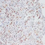 Merck ANTI-KI67 ANTIBODY PRODUCED IN RABBIT