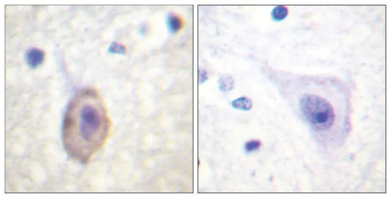 Merck Anti-VEGFR1 antibody produced in rabbit