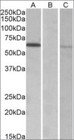 Merck ANTI-MKRN1