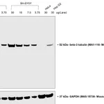 Thermo Fisher Scientific Goat anti-Mouse IgG2a Secondary Antibody, HRP